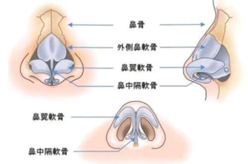 鼻修复 鼻修复