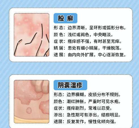 男性私密.jpg 男性私密.jpg