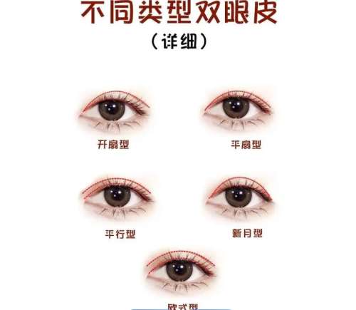 双眼皮