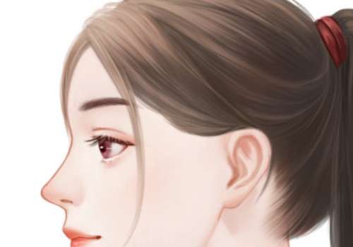 种植鬓角.jpg