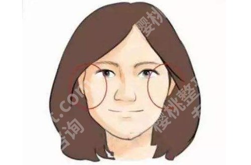 黄大勇下颌角颧骨推怎么样?内附医生信息简介与作者医院详情