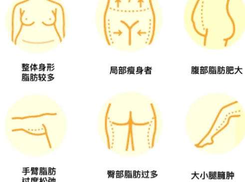 吸脂2.jpg