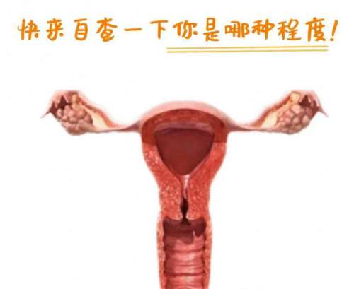私密紧缩