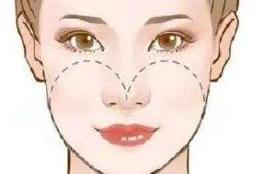 磨骨 磨骨