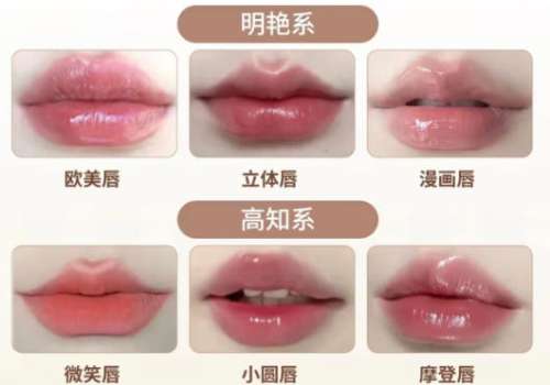 丰唇