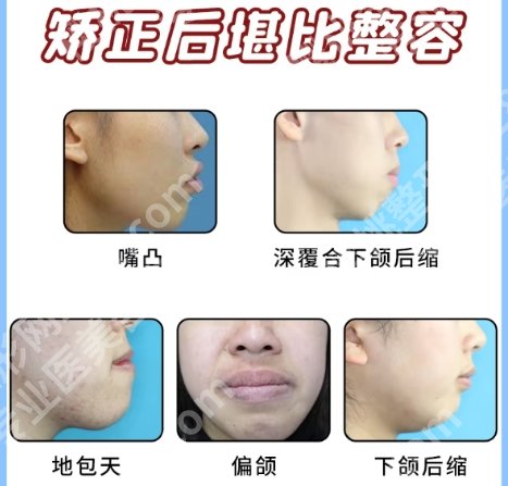 长春牙齿矫正哪个医生好?孙新华/许云鹤/朱宪春技术超群!