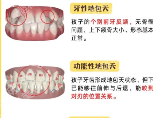 郑州牙齿矫正费用大概多少?价格在1w左右含人气医院推荐!