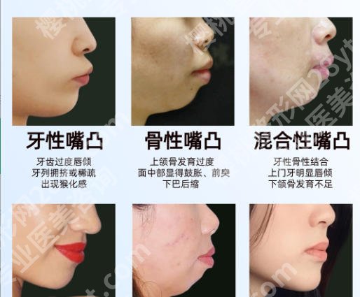 石家庄牙齿矫正好的医院有哪些?这些医院实力上榜、技术高超!