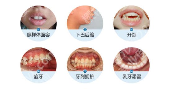 台州牙齿矫正医院推荐名单出炉!含各大医院基本资料