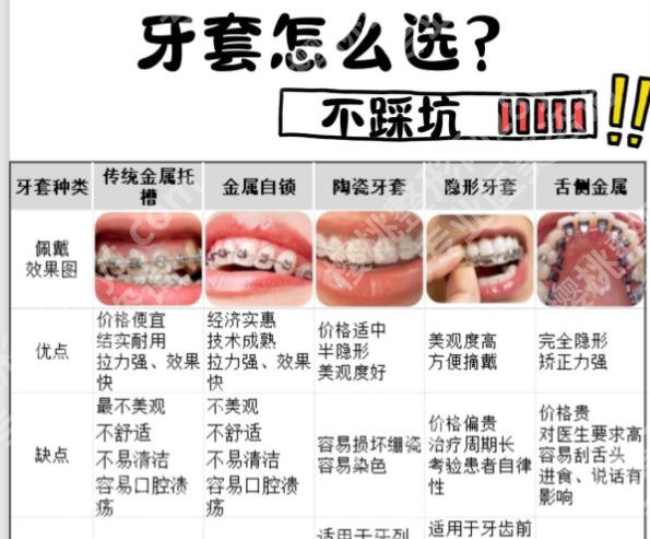 昆明牙齿矫正医院推荐名单一览!热门机构等你来选!