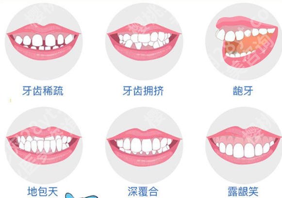 温州牙齿矫正哪个医院好?这几家医院口碑好名气大!