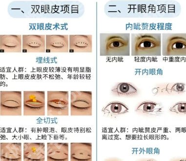 唐永丰医师怎么样?医生简介|双眼皮面诊过程分享!