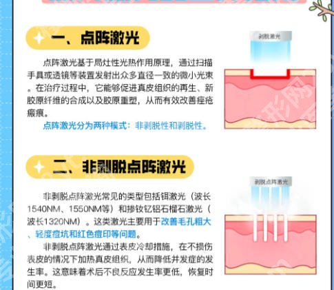 昆明点阵激光打一次的价格是多少?价格低至3k起有人气医院推荐!