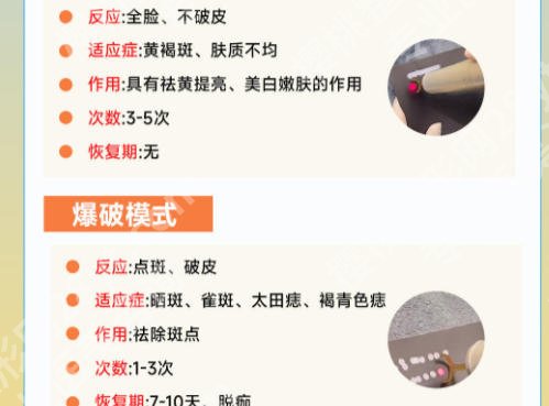济南皮秒点阵激光去纹身哪家好？这些权威医院可轻松净肤