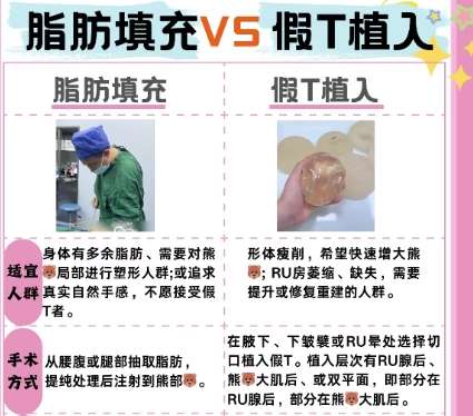 隆胸