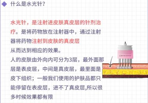水光针