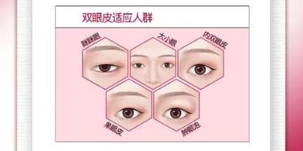 双眼皮