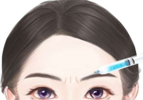 注射去川字纹.jpg