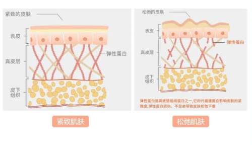 注射胶原蛋白美容