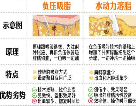吸脂 吸脂