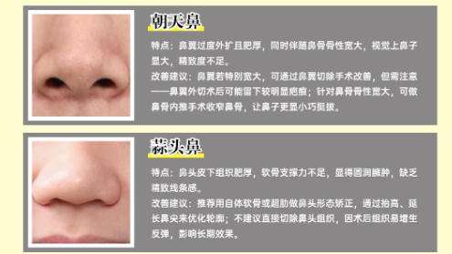 隆鼻11.jpg