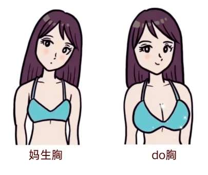 隆胸 隆胸