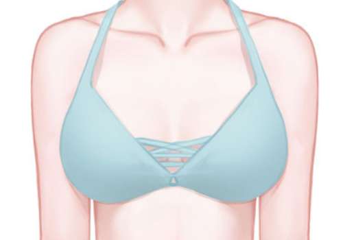 乳房缩小.jpg