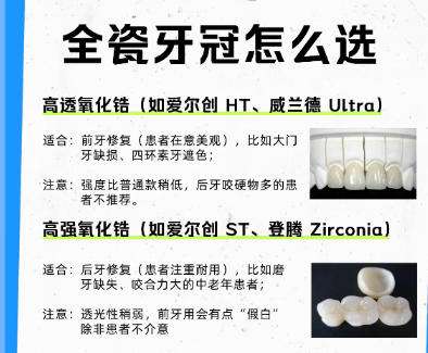 全瓷牙 全瓷牙