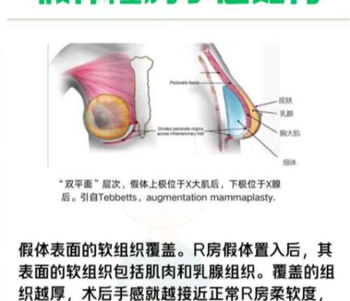 隆胸 隆胸