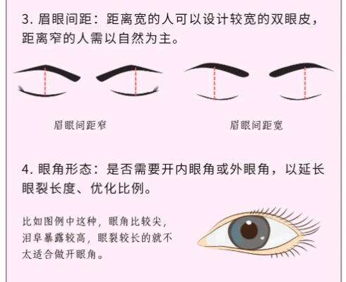 双眼皮 双眼皮