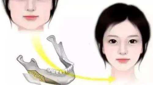 磨骨