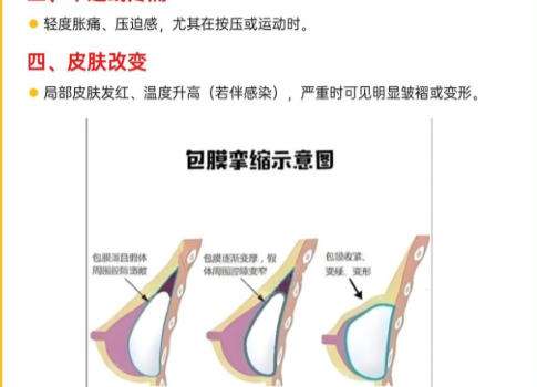 丰胸6.jpg 丰胸6.jpg