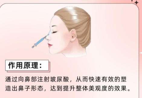 隆鼻B.jpg 隆鼻B.jpg