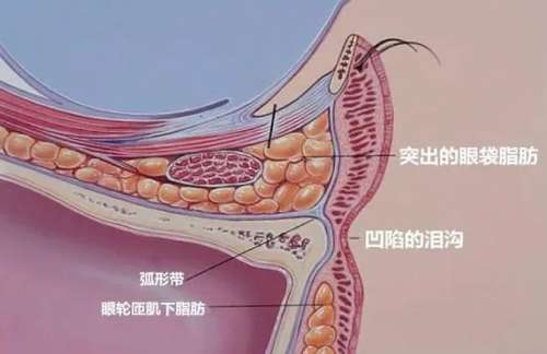 眼袋