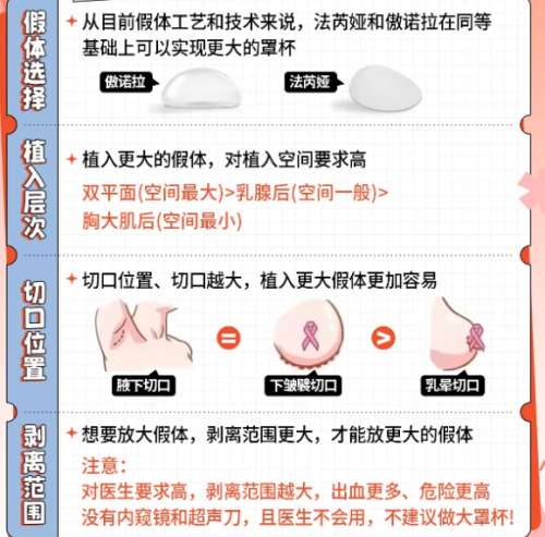 隆胸