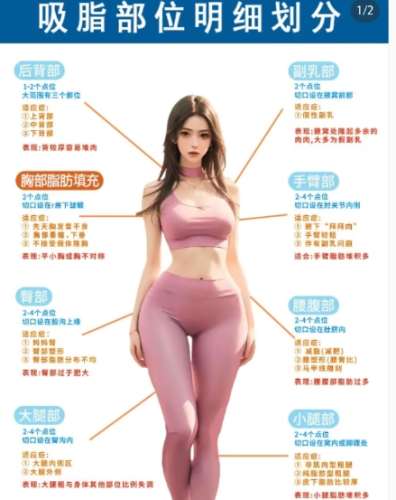 吸脂 吸脂