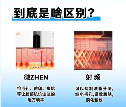 光子嫩肤