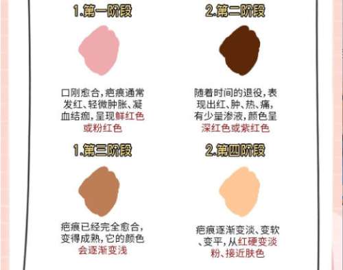 祛疤3.jpg