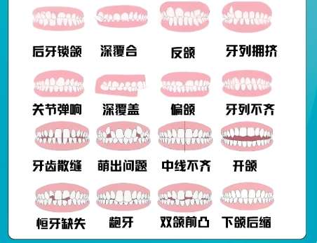 正颌 正颌