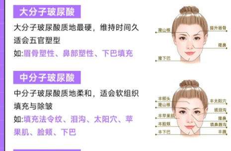 玻尿酸填充1.jpg 玻尿酸填充1.jpg