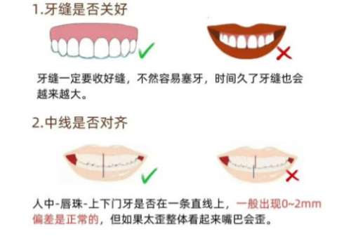 牙齿矫正1.jpg 牙齿矫正1.jpg