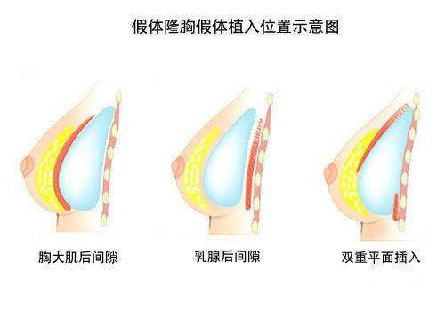 u=1808010899,367695496&fm=26&gp=0.jpg