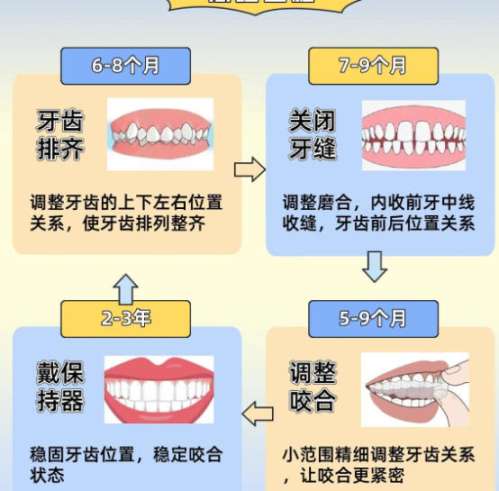 牙齿矫正 牙齿矫正