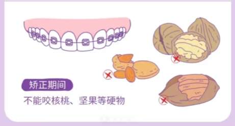 牙齿矫正