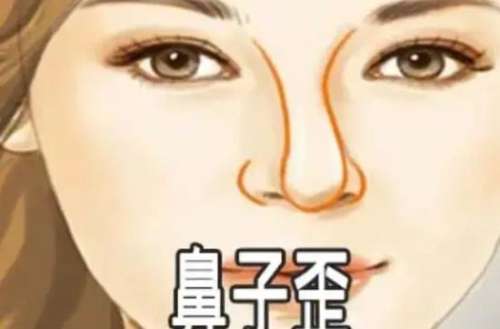 歪鼻矫正动漫04.jpg