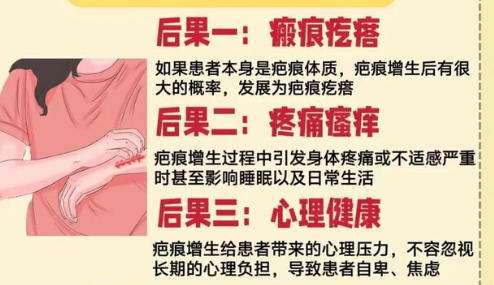 祛疤5.jpg 祛疤5.jpg