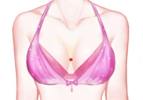 美胸护理.jpg