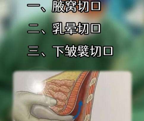 丰胸2.jpg 丰胸2.jpg