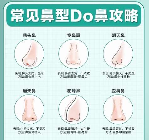 隆鼻
