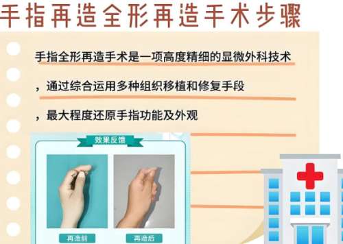 手指整形再造